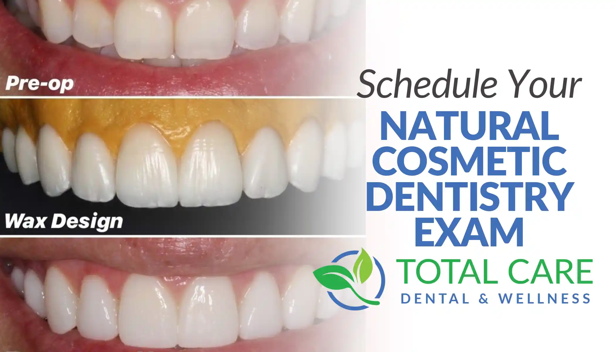 schedule your natural cosmetic dentistry exam