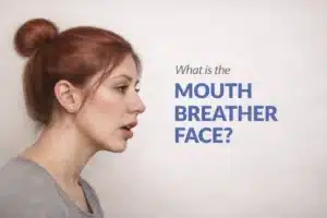 What is Mouth Breather Face