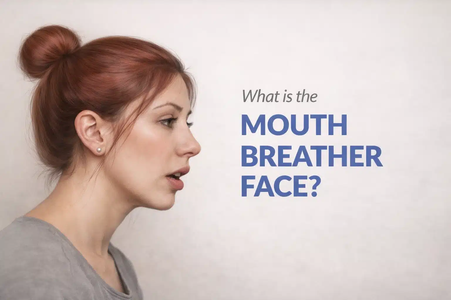What is Mouth Breather Face