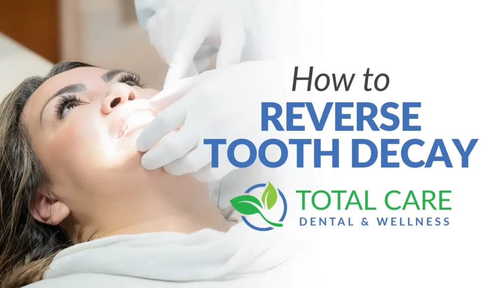 How to reverse tooth decay