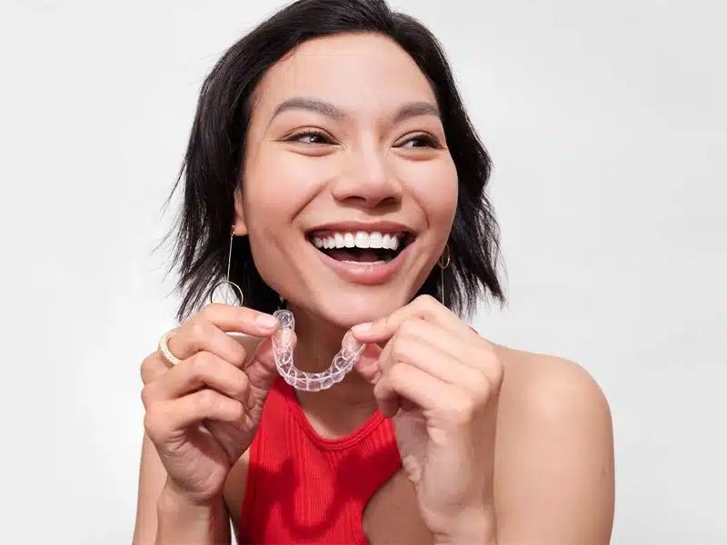 Candid Clear Aligners